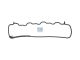 DT Spare Parts 4.20832 Dichtung, Zylinderkopfhaube passend für Mercedes-Benz