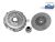 DT Spare Parts 3.94005 Kupplungssatz, D: 430 mm passend für MAN